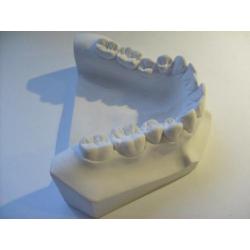 VERY RARE! zwaar 20cm sculptuur beeld GEBIT tr tand tandarts